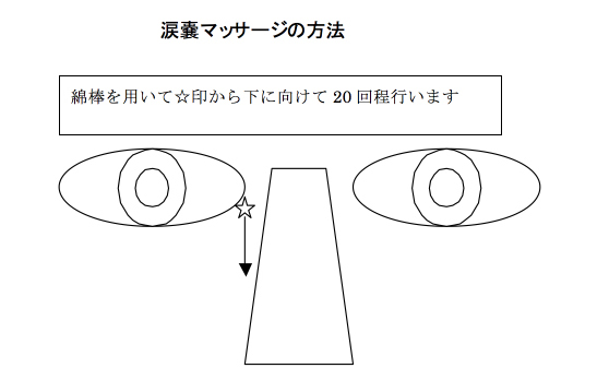 先天性鼻涙管閉塞症